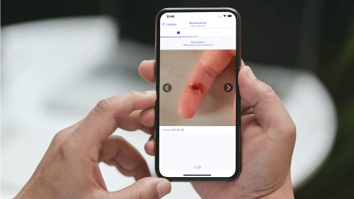 Mano sosteniendo aplicación que muestra una herida de dedo
